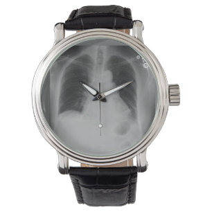 De Pulsera Reloj del ~ del rayo del pecho X