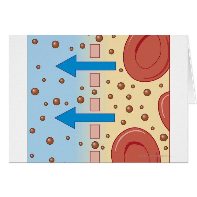 Diálisis renal (Anverso (Horizontal))