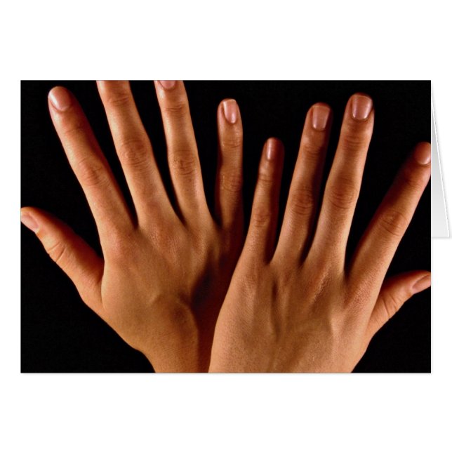 Dos manos cruzadas (Anverso (Horizontal))