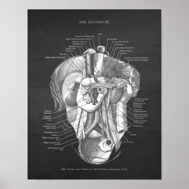 Duodeno Anatomía Arte Gastroenterólogo Decoración  (Frente)