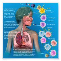 Alergias: poster de respuesta inflamatoria IgE