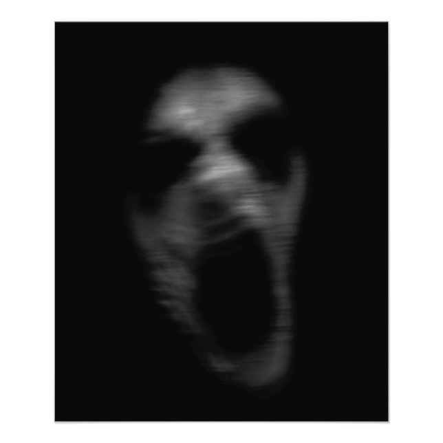 Foto Alteraciones mentales de caída (Frente)