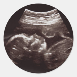 Foto de ultrasonido Baby Shower Gracias Sello