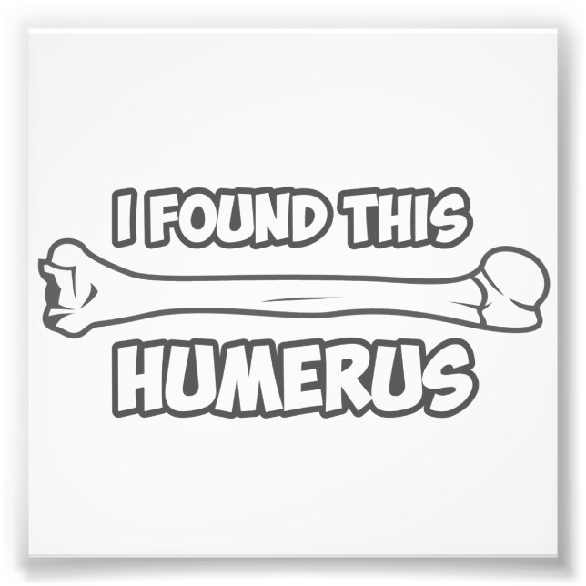 Foto Encontré Este Humerus (Frente)