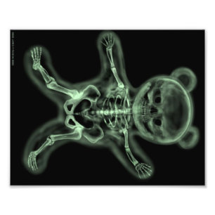 Foto Esqueleto de la radiografía de un poster del arte