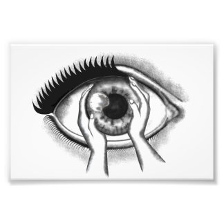 Foto Ojo derecho - Ojo derecho