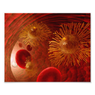 Foto Poster de la metástasis del cáncer