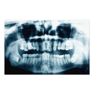 Foto Rayo X de dientes