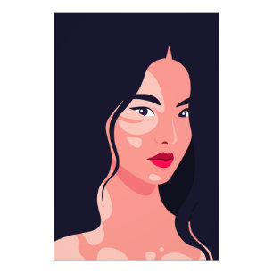 Foto Retrato de mujer asiática con vitiligo belleza vec