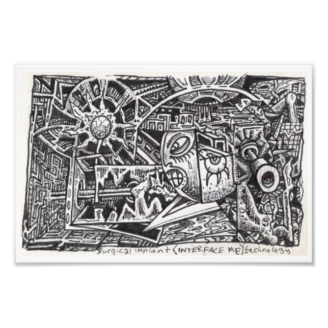 Foto Tecnología de Implante Quirúrgico (Interface Me) (Frente)