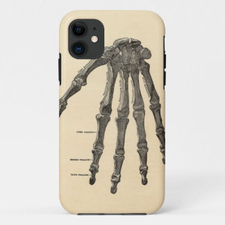 title_seo2 Caso médico del iPhone de los huesos de mano de la