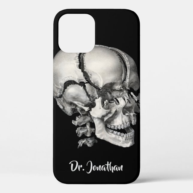 Funda De Case-Mate Para iPhone Ciencia Antigüeda Anatomía Humana, Cráneo Antiguo (Reverso )