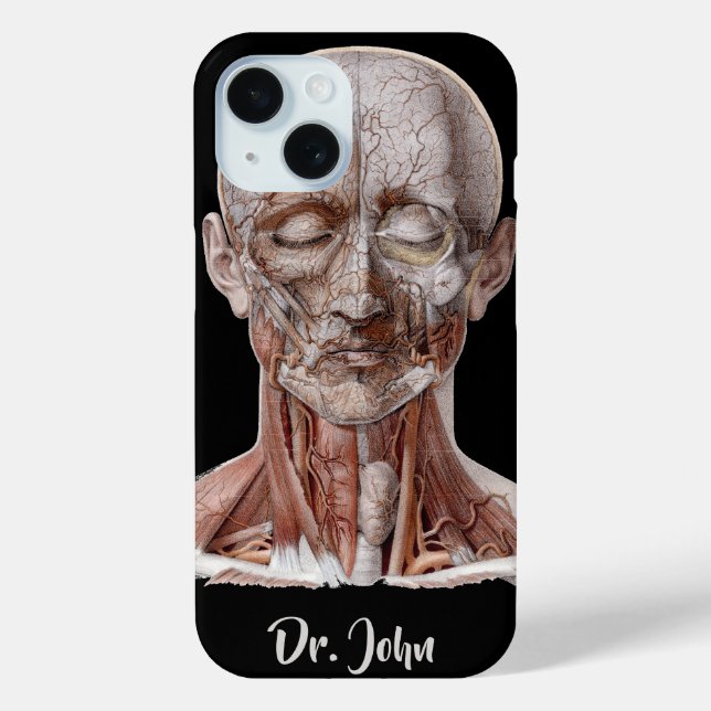 Funda De Case-Mate Para iPhone Ciencia de anatomía humana antigua, cabeza gargant (Reverso )