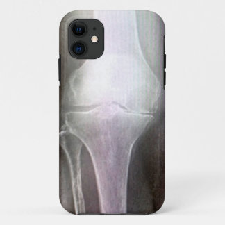 FUNDA PARA iPhone 11 CUBIERTA DE LA RADIOGRAFÍA IPHONE DE LA RODILLA