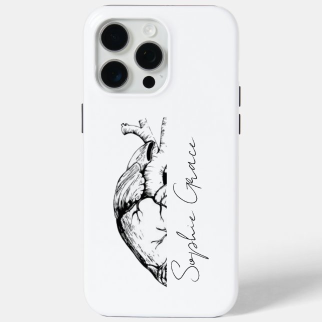 Funda De Case-Mate Para iPhone Estuche para iPhone personalizado y elegante con f (Reverso )