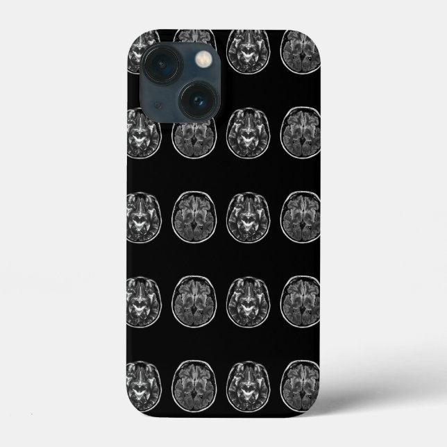 Funda De Case-Mate Para iPhone Exploración de mri cerebrales (Reverso )