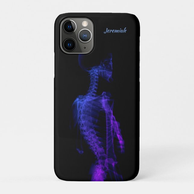 Funda De Case-Mate Para iPhone Hermosa radiografía de medio cuerpo (Reverso)