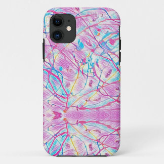 Funda Para iPhone 11 Manicura 17