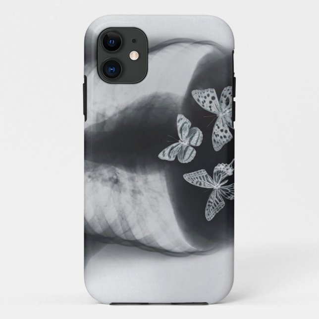 Funda De Case-Mate Para iPhone Radiografía de mariposas en el estómago (Reverso)