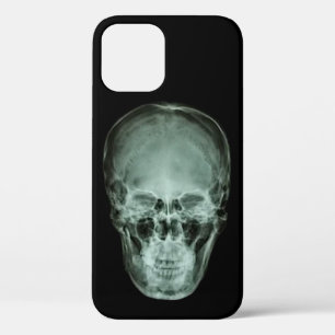 Funda Para iPhone 12 Rayo X del cráneo