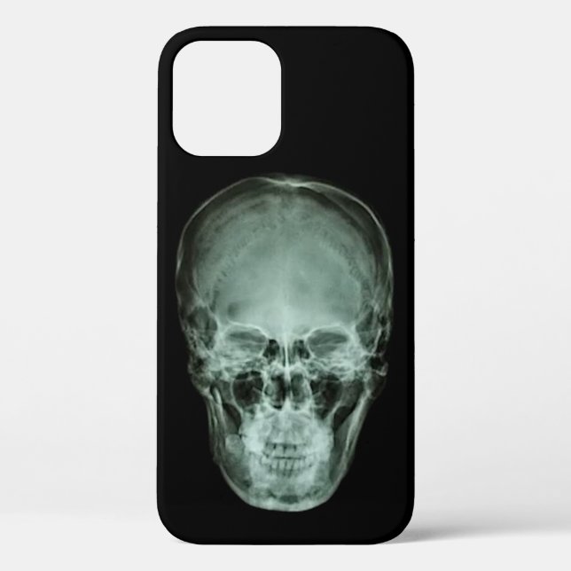Funda De Case-Mate Para iPhone Rayo X del cráneo (Reverso )