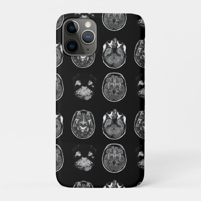 Funda De Case-Mate Para iPhone Resonancia magnética cerebral (Reverso)
