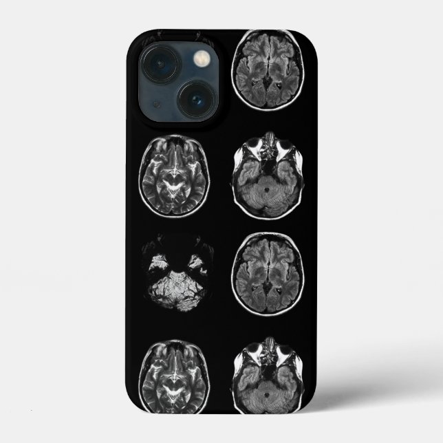 Funda De Case-Mate Para iPhone Resonancia magnética cerebral (Reverso )