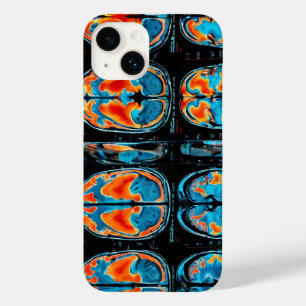 Funda Para iPhone 14 De Case-Mate resonancia magnética del cerebro
