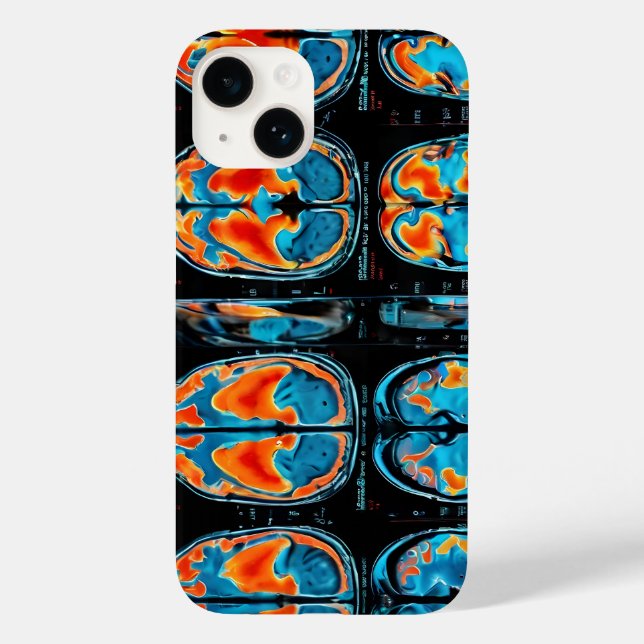 Funda De Case-Mate Para iPhone resonancia magnética del cerebro (Reverso )