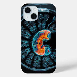 Funda Para iPhone 15 resonancia magnética del cerebro