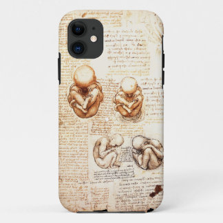 Funda Para iPhone 11 Vistas de un feto en el útero, Ob-Gyn Medical