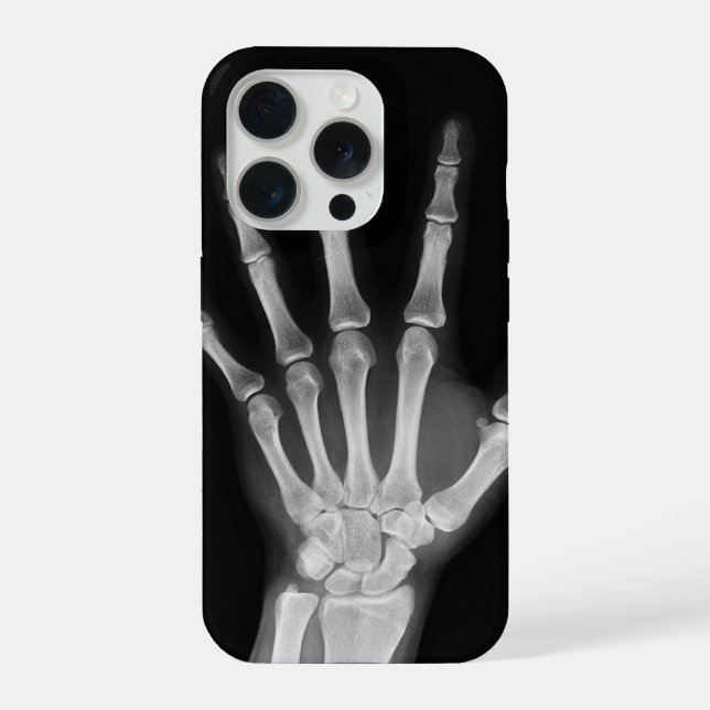 Funda para iPhone 15 Pro con esqueleto (Reverso )