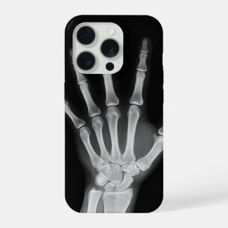 Funda para iPhone 15 pro esqueleto