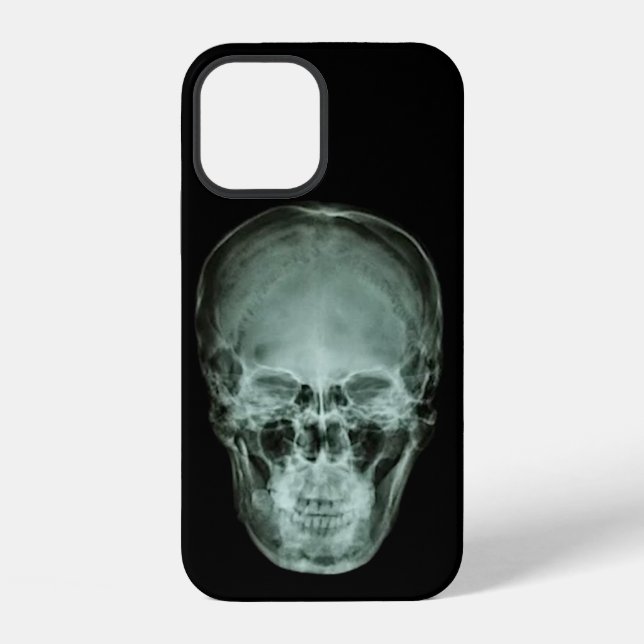 Funda Para iPhone Radiografía de cráneo de cabeza (Reverso )