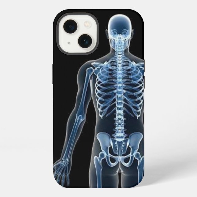 Funda Para iPhone Radiografía de John Doe (Reverso )