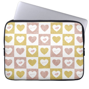 Funda Para Portátil abrazo y besos