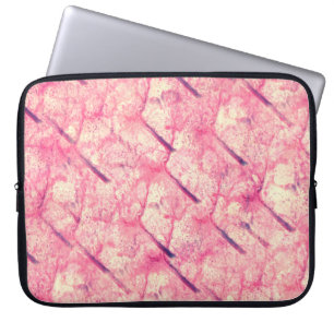 Funda Para Portátil arte La acuarela rosa de la pintura tintada de col