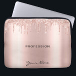 Funda Para Portátil Artista de maquillaje Eyelash Lazas Purpurina Drin<br><div class="desc">El Purpurina de moda Rosa oro gotea el guión de los latigazos Rosa de la manga portátil Gold. Fabuloso artista de maquillaje Eyelash Lashes diseño con texto de caligrafía de escritura, oro rosa gotea purpurinas y un llamativo fondo elegante. Personalizado este diseño femenino de manga de portátil añadiendo tu nombre,...</div>
