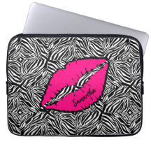 Cebra simple con labios rosados personalizados
