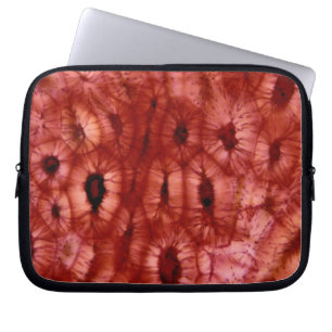 Funda Para Portátil Células de Sclerenchyma de un hoyo de la cereza