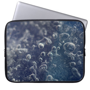 Funda Para Portátil Choceradská