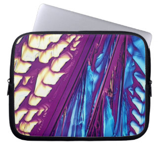 Funda Para Portátil Cristales del ácido tartárico