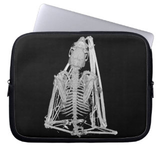 Funda Para Portátil Esqueleto de murciélago gótico espeluznante