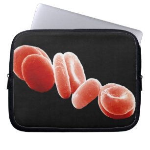 Funda Para Portátil Glóbulos rojos