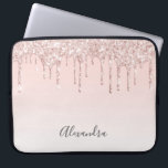Funda Para Portátil guión de nombre de goteo rosa de color rosa de col<br><div class="desc">Una elegante caja de ipad de glamur y gambas. Faux rosa oro y goteo purpurina rosado,  goteo de pintura. rosa de moda de fondo sombrío dorado. Inserte su nombre,  escrito con un guión de estilo moderno con letras a mano. Letras de color gris.</div>