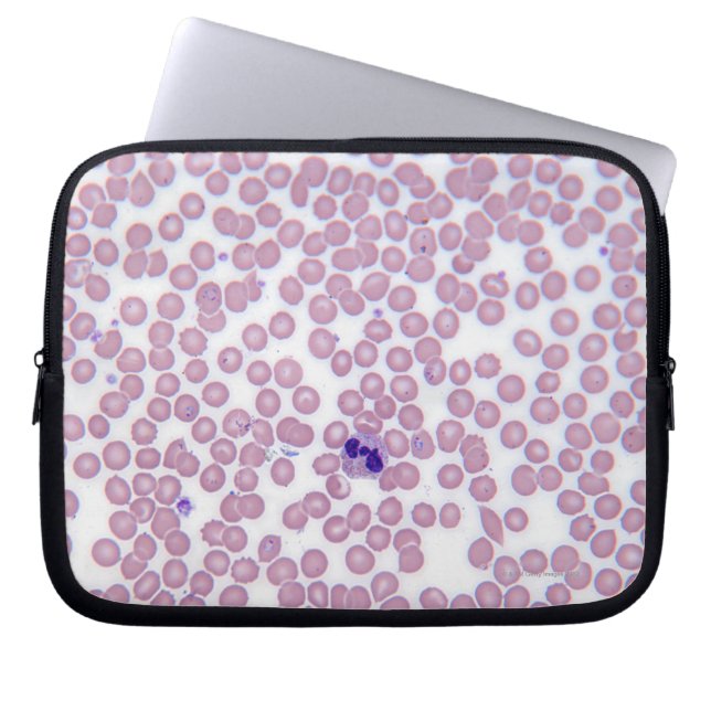 Funda Para Portátil Hemorragia (Frente)