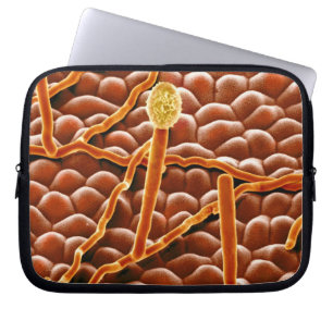 Funda Para Portátil Hongo del moho polvoriento en Poinsettia