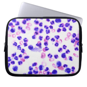 Funda Para Portátil Infección por Staph