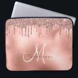 Funda Para Portátil Monograma de Rosa de golosinas Purpurinas de oro<br><div class="desc">Este diseño puede ser personalizado en el área proporcionada cambiando la foto y/o el texto. O puede personalizarse haciendo clic en Personalizar esta plantilla y, a continuación, eligiendo la opción de hacer clic en el personalizar y eliminando o cambiando el color del fondo, agregando texto, cambiando el color o estilo...</div>