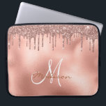Funda Para Portátil Monograma de Rosa de golosinas Purpurinas de oro<br><div class="desc">Este diseño puede ser personalizado en el área proporcionada cambiando la foto y/o el texto. O puede personalizarse haciendo clic en Personalizar esta plantilla y, a continuación, eligiendo la opción de hacer clic en el personalizar y eliminando o cambiando el color del fondo, agregando texto, cambiando el color o estilo...</div>